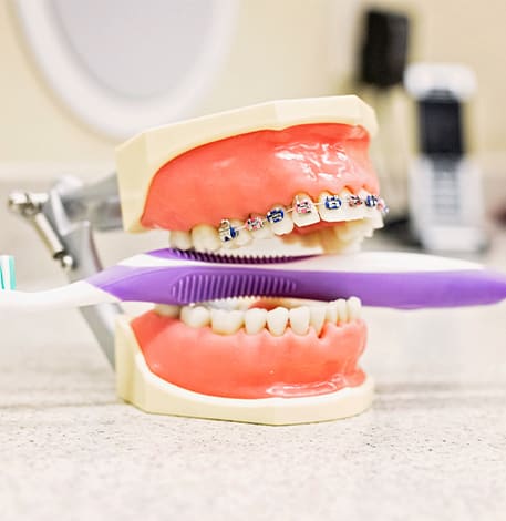 Orthodontics | Assiniboine Dental Group | St. James, Winnipeg Dentist